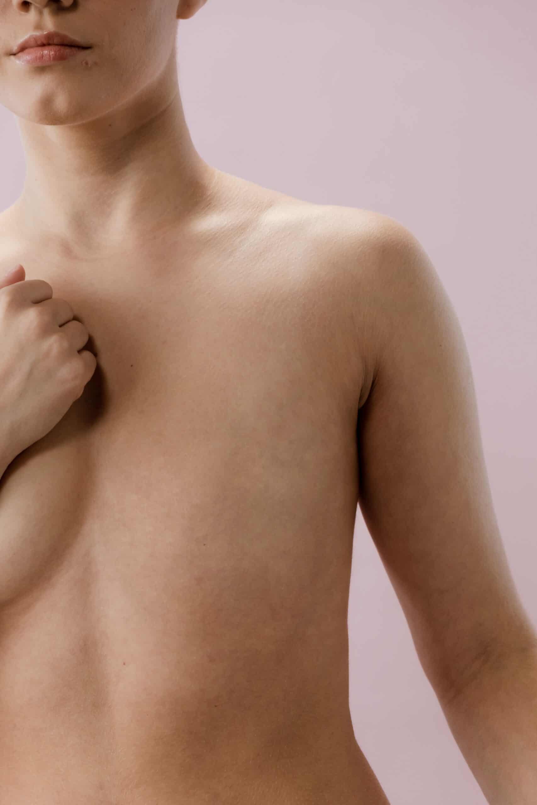 Mastectomy