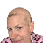 Chemo Hair Loss